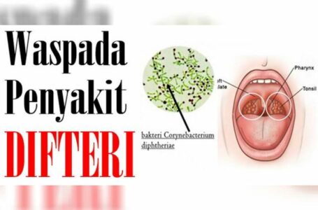 Difteri Makin Mengancam, Komisi IX DPR Geram Kinerja Kemenkes tak Optimal